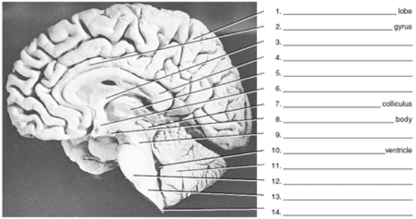 Label all 14 parts of this midsagittal view of a human brain.   