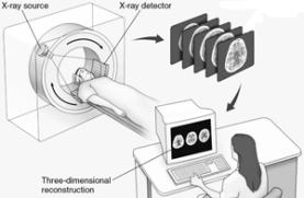   -Which of the following provides the most detailed three-dimensional view of the structure of the living human brain? A)  CT B)  PET C)  angiography D)  EEG E)  MRI
