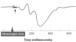   -The short-latency low-amplitude signals (indicated by the arrow) in this average auditory evoked potential are termed A)  the P300. B)  the P400. C)  the ERP. D)  the sensory evoked potential. E)  far-field potentials.