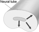   -The pattern of neural migration that is indicated by the arrows in this illustration is A)  radial. B)  tangential. C)  inside out. D)  outside in. E)  posterior.