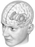 Illustrated here   A)  is the limbic system. B)  is the diencephalon. C)  is the reticular formation. D)  are the basal ganglia. E)  is the medulla.