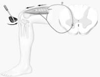 Illustrated here is a   A)  patellar tendon reflex. B)  withdrawal reflex. C)  stretch reflex. D)  both A and B E)  both A and C