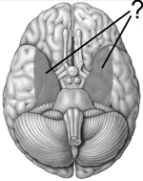 The shaded areas on this drawing of the inferior surface of the brain illustrate the position of the   A)  hippocampuses. B)  amygdalas. C)  striatums. D)  medial parietal lobes. E)  medial temporal lobes.
