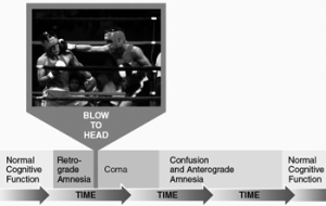 Illustrated here is the time course of events occurring before and after   A)  concussion. B)  contusion. C)  consolidation. D)  islands of memory. E)  none of the above