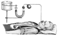 The conclusion of the 1912 study illustrated here was that stomach contractions are associated with   A)  eating. B)  hunger. C)  pain. D)  gas. E)  excess satiety.