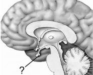 Which structure is indicated here?   A)  anterior pituitary B)  posterior pituitary C)  hypothalamus D)  mammillary body E)  pineal