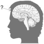 The cerebral commissure indicated here is the   A)  corpus callosum. B)  posterior commissure. C)  anterior commissure. D)  hippocampal commissure. E)  massa commissura.