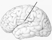 Which component of the Wernicke-Geschwind model is illustrated here?   A)  Broca's area B)  Wernicke's area C)  angular gyrus D)  arcuate fasciculus E)  auditory cortex