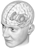 Illustrated here   A)  is the limbic system. B)  is the diencephalon. C)  is the reticular formation. D)  are the basal ganglia. E)  is the medulla.