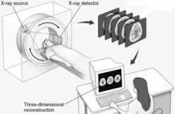 Which technique is illustrated here?   A)  computed tomography B)  cerebral angiography C)  electroencephalography D)  magnetic resonance imaging E)  positron emission tomography