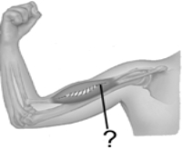 The tiny muscle at the end of the pointer line is   A)  an intrafusal muscle. B)  an extrafusal muscle. C)  a skeletal muscle. D)  both A and C E)  Both B and C