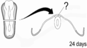 At 24 days after conception,the precursor of the PNS is visible in the developing embryo,just dorsal to the developing spinal cord.This structure,which is illustrated here at the end of the pointer line,is the neural   A)  tube. B)  plate. C)  crest. D)  groove. E)  stem.
