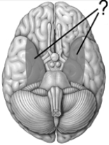 The shaded areas on this drawing of the inferior surface of the brain illustrate the position of the   A)  hippocampuses. B)  amygdalas. C)  striatums. D)  medial parietal lobes. E)  medial temporal lobes.