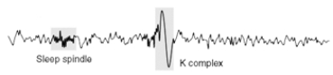 Which stage of sleep EEG is illustrated here?   A)  initial stage 1 B)  stage 2 C)  stage 3 D)  emergent stage 1 E)  REM