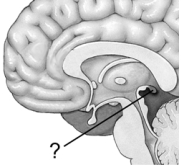 Illustrated here is the location of the   A)  pineal gland. B)  pituitary gland. C)  suprachiasmatic nucleus. D)  posterior thalamus. E)  uvula.