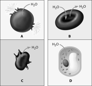 Which figure depicts an animal cell placed in a solution hypotonic to the cell?   A) cell A B) cell B C) cell C D) cell D