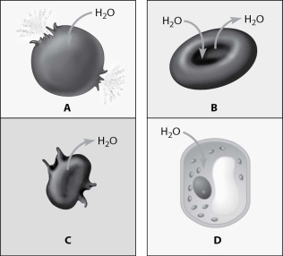 Which figure depicts an animal cell placed in a solution hypotonic to the cell?   A) cell A B) cell B C) cell C D) cell D