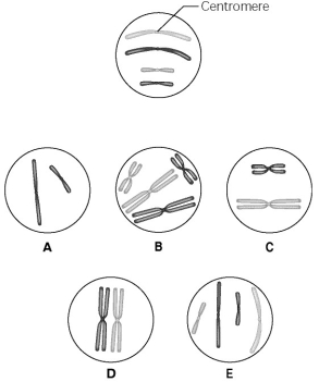 Use the following information to answer the questions below. The lettered circle in Figure 12.1 shows a diploid nucleus with four chromosomes. There are two pairs of homologous chromosomes, one long and the other short. One haploid set is symbolized as black and the other haploid set is gray. The chromosomes in the unlettered circle have not yet replicated. Choose the correct chromosomal conditions for the following stages.     Figure 12.1 -What is the correct chromosomal condition at the prometaphase of mitosis? A)  A B)  B C)  C D)  D E)  E 