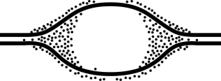    Grains represent radioactive material within the replicating eye. -In an experiment, DNA is allowed to replicate in an environment with all necessary enzymes, dATP, dCTP, dGTP, and radioactively labeled dTTP (³H thymidine) for several minutes and then switched to nonradioactive medium. It is then viewed by electron microscopy and autoradiography. The figure above represents the results. Which of the following is the most likely interpretation? A)  There are two replication forks going in opposite directions. B)  Thymidine is only being added where the DNA strands are furthest apart. C)  Thymidine is only added at the very beginning of replication. D)  Replication proceeds in one direction only. 