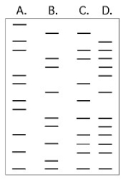 Use Figure 20.3 to answer the following questions. The DNA profiles that follow represent four different individuals.     Figure 20.3 -Which of the following are probably siblings? A)  A and B B)  A and C C)  A and D D)  C and D E)  B and D 