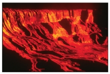 Comparing these two photographs,which eruption has lower viscosity magma?     A) the fluid cascade of lava B) the circular volcanic feature C) they could have the same viscosity D) there is no way to tell