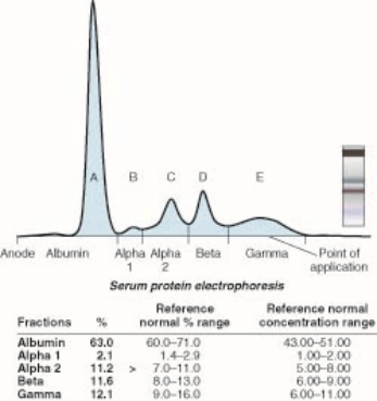In which peak in the figure is the albumin?    A) A B) B C) C D) D E) E