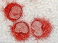 The cell type shown below is found between follicles in lymph nodes and expresses B7-1,B7-2,and class II MHC.What type of cell is this?   A) B cell B) Follicular dendritic cell C) Thymic epithelial cell D) Dendritic cell E) Plasma cell 