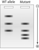 You set up an EcoRI restriction digest for a sample of genomic DNA from an individual with a mutation in the β-globin gene. You perform a Southern blot using the entire β-globin gene as a probe. To your surprise, you notice a different pattern of bands in the affected individual - you have identified a new SNP! What can you conclude from the pattern of bands from the Southern blot below?   A) The SNP resulted in the loss of an EcoRI site. B) The SNP resulted in the creation of a new EcoRI site. C) The SNP resulted in the loss of an exon. D) The SNP results in the creation of a new HindIII site. E) There was no change in the genomic DNA sequence.