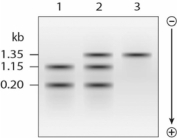 Based only on this Southern blot and with no knowledge of which of the β-globin SNPs you are looking at, which lane(s)might represent(s)a heterozygous individual?  
