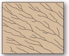   This drainage pattern is associated with steep slopes. A) parallel B) dendritic C) trellis D) deranged E) radial