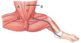 Identify the linea alba in the following figure.   A)  A B)  B C)  C D)  D
