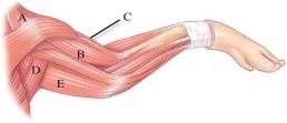 Identify the brachialis in the following figure.   A)  A B)  B C)  C D)  D E)  E