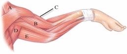 <strong>Identify the brachiocephalic.  </strong> A) A B) B C) C D) D E) E <div style=padding-top: 35px> 