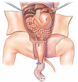 Identify the gallbladder in the following figure.   A)  A B)  B C)  C D)  D E)  E