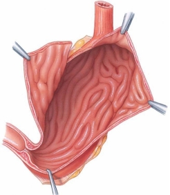 The large folds of the stomach mucosa (shown here)  are called ________.   A)  rugae B)  mesentery C)  villi D)  papillae