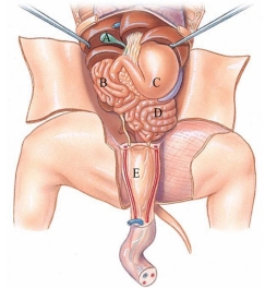 Identify the large intestine in the following figure.   A)  A B)  B C)  C D)  D E)  E