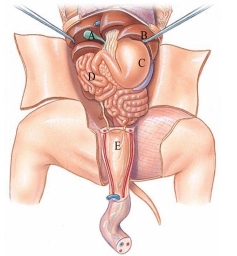 Identify the gallbladder in the following figure.   A)  A B)  B C)  C D)  D E)  E