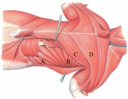 Identify the serratus ventralis in the following image.   A)  A B)  B C)  C D)  D