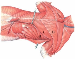 Identify the serratus dorsalis in the following image.   A)  A B)  B C)  C D)  D