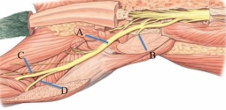 Identify the common fibular nerve in the following figure.   A)  A B)  B C)  C D)  D