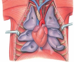 Identify the anterior lobe of the left lung in the figure shown.   A)  A B)  B C)  C D)  D E)  E