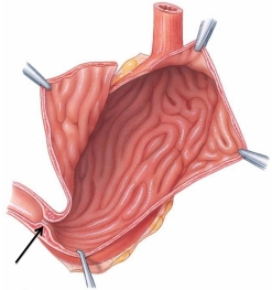 Identify the structure at the tip of the arrow in this figure.   A)  pyloric sphincter B)  lower esophageal sphincter C)  ileocecal sphincter D)  anal sphincter