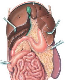Identify the left medial lobe of the liver in the following figure.   A)  A B)  B C)  C D)  D E)  E