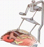 This retractor is used to elevate the sternal border to expose the:   A) internal mammary artery. B) aortic arch. C) superior vena cava and right atrium. D) anterolateral coronary arteries.