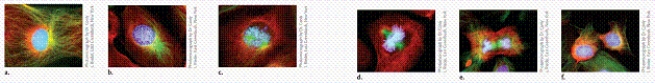   Photomicrograph by Dr. Conly L. Rieder, East Greenbush, New York -Which stage of mitosis is depicted in photo A in the figure? A) interphase B) metaphase C) prophase D) anaphase