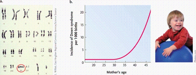   -Which genetic condition is revealed in the karyotype display? A) cri-du-chat B) triple-X syndrome C) Turner syndrome D) Down syndrome