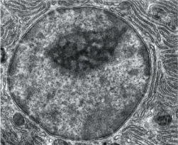 The very large organelle shown below has genetic control of a cell's activities. What is the name of this structure?   A)  Mitochondrion B)  Endoplasmic reticulum C)  Nucleus D)  Vacuole E)  Golgi apparatus