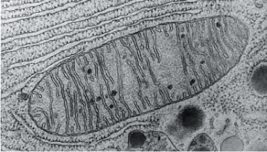 The organelle shown below is found in all cells but is most numerous in cells requiring a large amount of energy (e.g., liver cells) . What is the name of this organelle?   A)  Lysosome B)  Golgi apparatus C)  Rough endoplasmic reticulum D)  Mitochondrion E)  Chloroplast