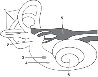 Refer to the diagram below of the ear. Which of the following statements about the diagram is false?   A)  Stereocilia embedded in cupulae are found in structure 1. B)  Sound waves in air are converted into fluid waves when the stapes move against the structure covering the opening at position 4. C)  The position and orientation of the head are sensed by structure 1. D)  Otoliths are found on top of a gelatinous substance in the structure indicated by 2. E)  Damage to structure 5 can cause deafness.