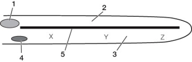 Refer to the diagram below of the cochlea. Which of the following statements about the diagram is true?   A)  If structure 1 vibrates slowly, the displacement pressure is dissipated by outward bulging of structure 4. B)  If structure 1 vibrates rapidly, structure 5 flexes. C)  The more rapid the vibrations of structure 1, the greater the amplitude of flexion of structure 5 at position X. D)  High-pitch sound waves are detected at position Z. E)  The organ of Corti is part of structure 5.